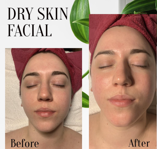 skincare-routine-for-dry-skin