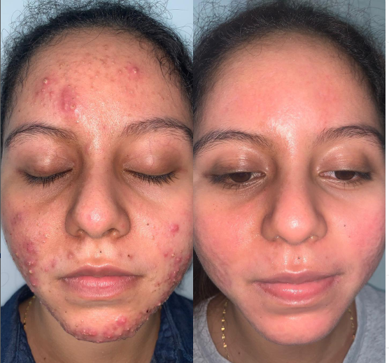 10 Skincare Habits That Are Gradually Destroying Your Skin